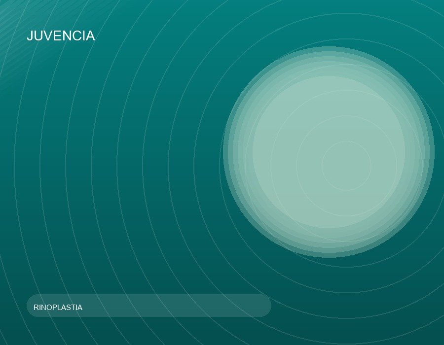 Rinoplastia